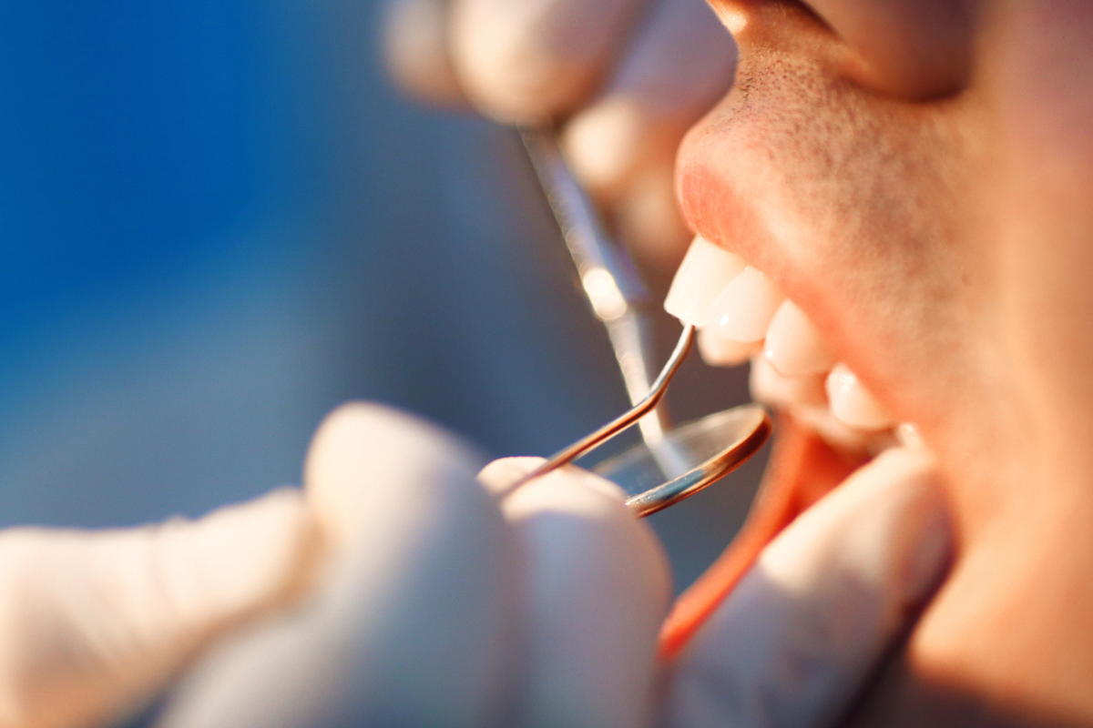 Laser Dentistry: The Future of Painless and Precise Dental Care